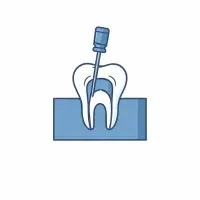 Root Canal Treatment