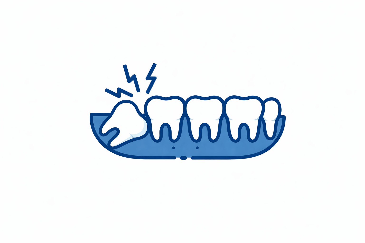 Wisdom Tooth Extraction